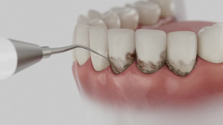 Reliable Dental Implants contractor in Manhattan, KS by Smile Center Dentistry